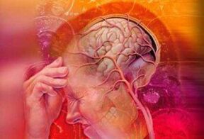 Hipertensión contra la osteocondrosis