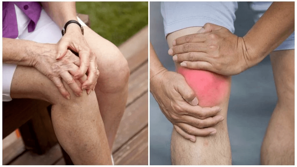 Tratamiento de la osteoartritis